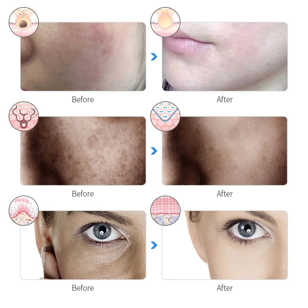RadiantSkin Pro LED Therapy Mask